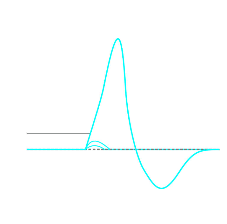 DB | Action Potential vs Synaptic Potential