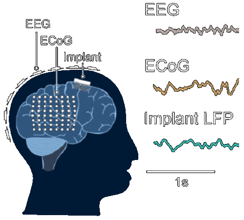 BMSeed | ECoG Electrodes