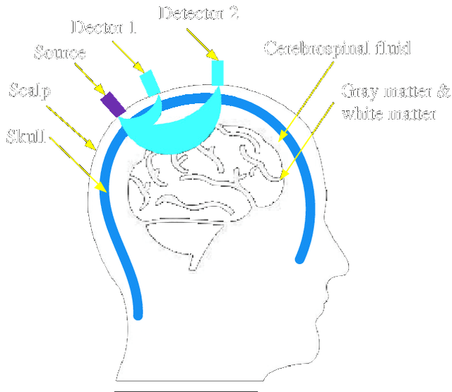 MCW | Applications of FNIRS in Neurotech